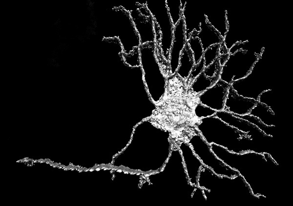 An example of the original neuronal imagery as supplied courtesy of Paul Rigby from the Centre for Microscopy, Characterisation and Analysis, University of Western Australia